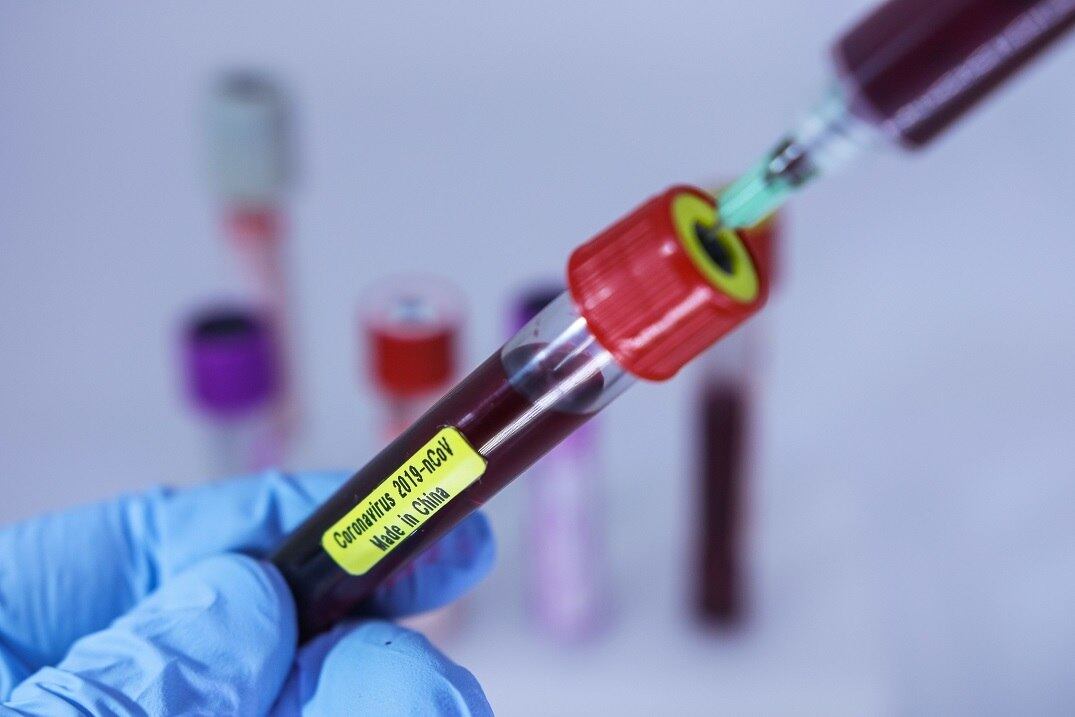 Itália vai fechar escolas e universidades por duas semanas
