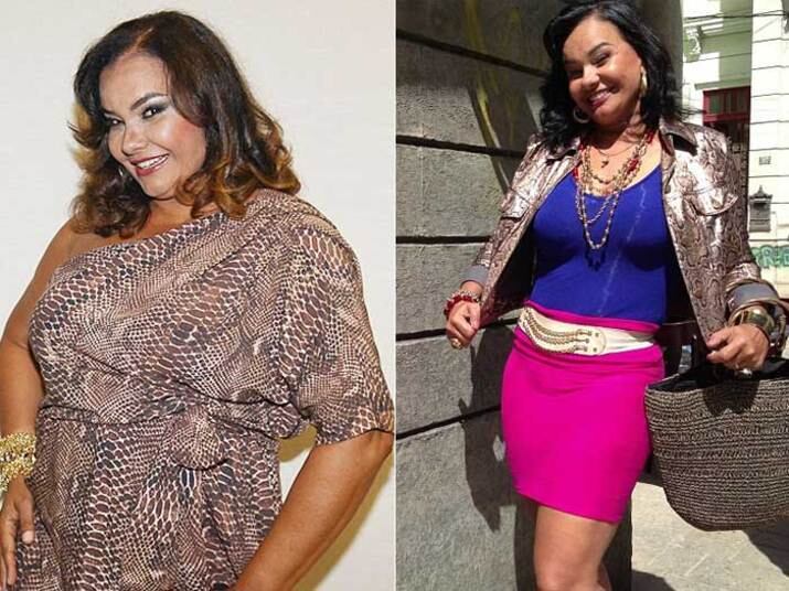 A atriz Solange Couto, por exemplo, só conseguiu se livrar do temido "efeito sanfona" após se submeter a uma cirurgia bariátrica. A cirurgia foi feita em janeiro de 2013 e até agora ela já emagreceu cerca de 20 kg e exibe uma silhueta bem mais enxuta. Ela afirma ter conquistado uma nova vida após a cirurgia.

— Cheguei à conclusão de que eu era gulosa e não tenho mais saco de fazer dieta e brincar de sanfona. Estava infeliz com meus 108kg. Não cabia nas minhas roupas, estava desanimada

Solange Couto emagrece 20 kg com cirurgia: "Não tenho mais saco de fazer dieta"