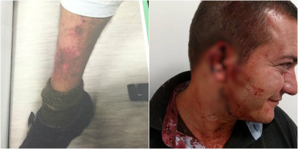 Policiais do 2°Distrito Policial do Bom Retiro, no centro de SP, feridos após confronto com a travesti Verônica Bolina