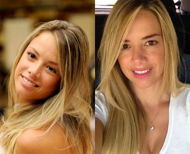 Fernanda participou do BBB 10. A moça voltou a trabalhar como dentista