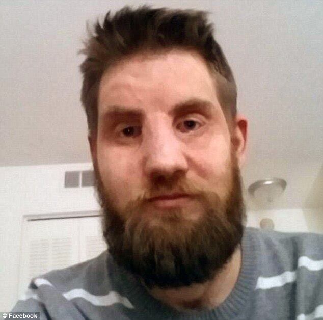 Agora com 35 anos, casado e com um filho, ele veio a público para falar sobre sua recuperação. Hunter afirma que nunca se sentiu melhor do que hoje