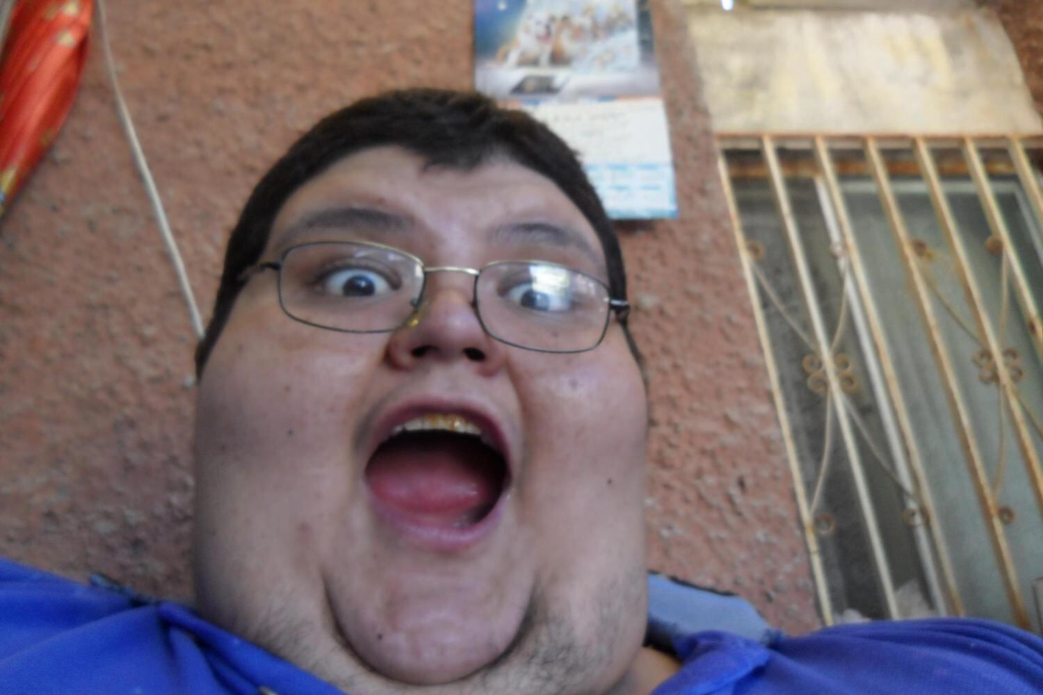 O hipotireoidismo fez com que o corpo de Salas armazenasse os alimentos, em vez de seu metabolismo queimá-los. E também teve como consequência uma diabetes do tipo 2, que causa hipertensão e picos de glicose no sangue