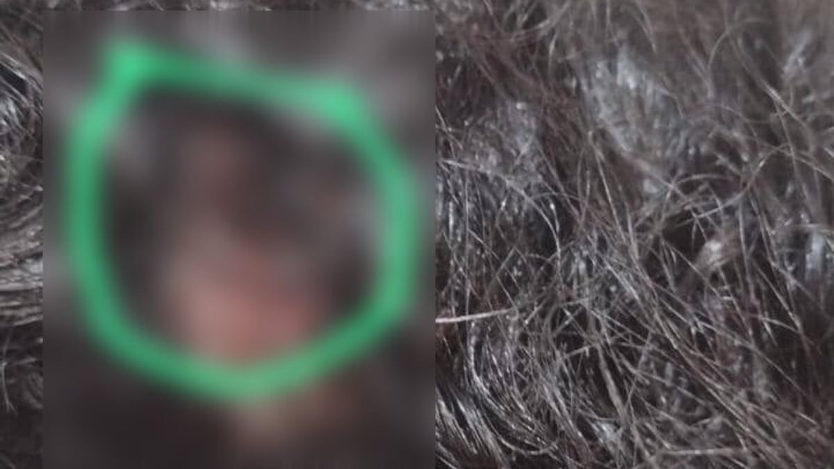 A jovem ainda tentou se esconder em uma área de mata próxima, porém foi atingida por dois tiros na cabeça, com projéteis alojados na região da cabeça e do pescoço