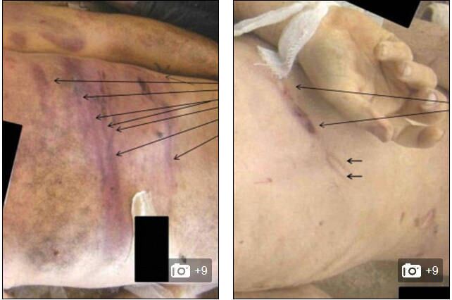 "César" conseguiu enviar as imagens da Síria graças a
contato no Movimento Nacional Sírio, apoiado pelo Catar.
O relatório será entregue à ONU, a governos e a organizações
humanitárias, segundo o The Guardian. As revelações coincidem com a
conferência de paz Genebra 2, que será realizado a partir da próxima quarta-feira (22), na
Suíça.