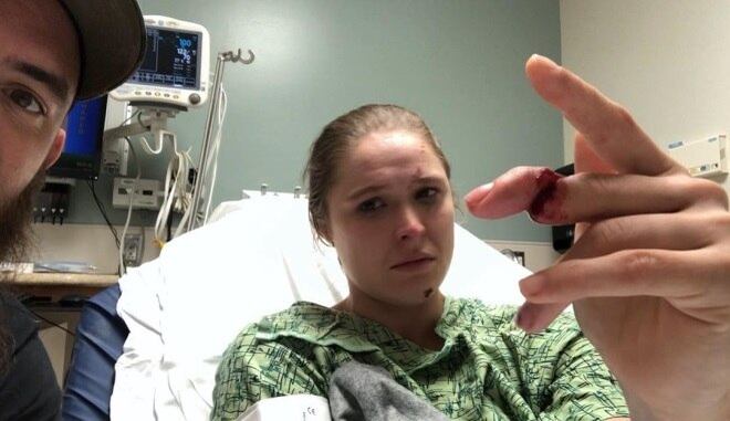 Ronda Rousey postou nas redes sociais o dedo fraturado