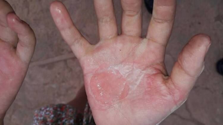 A criança contou o
ocorrido aos policiais, dizendo que a mãe a havia acusado de roubar o dinheiro.
A mulher ainda tentou bater na filha na frente dos PMs