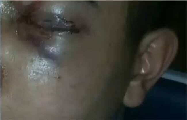 A Corregedoria da Polícia Militar do Estado de São Paulo marcou um
encontro para esta semana com a mãe e o jovem. O objetivo é tentar fazer um
reconhecimento fotográfico dos PMs suspeitos de terem participado da ação