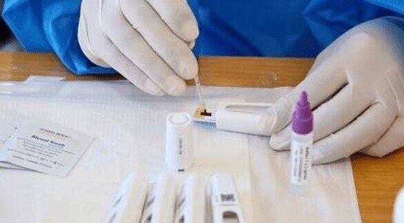 A rede privada de laboratórios do Brasil percebeu um aumento significativo na procura por testes de Covid-19 entre 5 e 11 de novembro, em comparação com a semana anterior. O número de exames realizados subiu 194%, segundo a Abramed (Associação Brasileira de Medicina Diagnóstica), cujos associados processam cerca de 60% de todos os testes da saúde suplementar no país. Quatro em cada dez exames realizados na semana passada tiveram diagnóstico confirmado de Covid