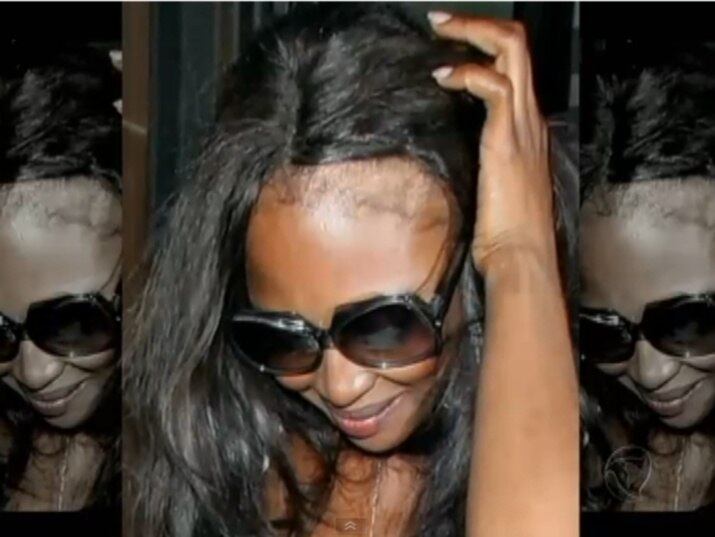 Truques para alongar as madeixas são perigosos para o couro cabeludo e
podem até deixar a mulher careca. A top model Naomi Campbel é o principal
exemplo de famosa que teve problemas por causa do uso do mega hair. Britney
Spears é outra. Navegue pela galeria e entenda os riscos que os apliques podem oferecer

No R7 Play você pode assistir ao
Fala Brasil na íntegra! Clique e experimente de graça!
+ Famosas perdem cabelos em decorrência de apliques; entenda os riscos
+ Tratamento inovador promete dar fim às tão indesejáveis estrias. Veja!
+ Famosas bebem vinagre de maçã para afinar a silhueta e manter a beleza
