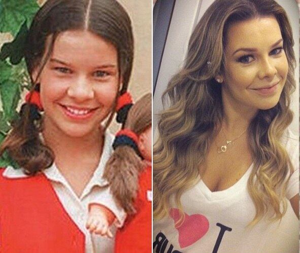 Segundo o jornal, Fernanda decidiu pela rinoplastia porque achava que o nariz não combinava com o rosto 