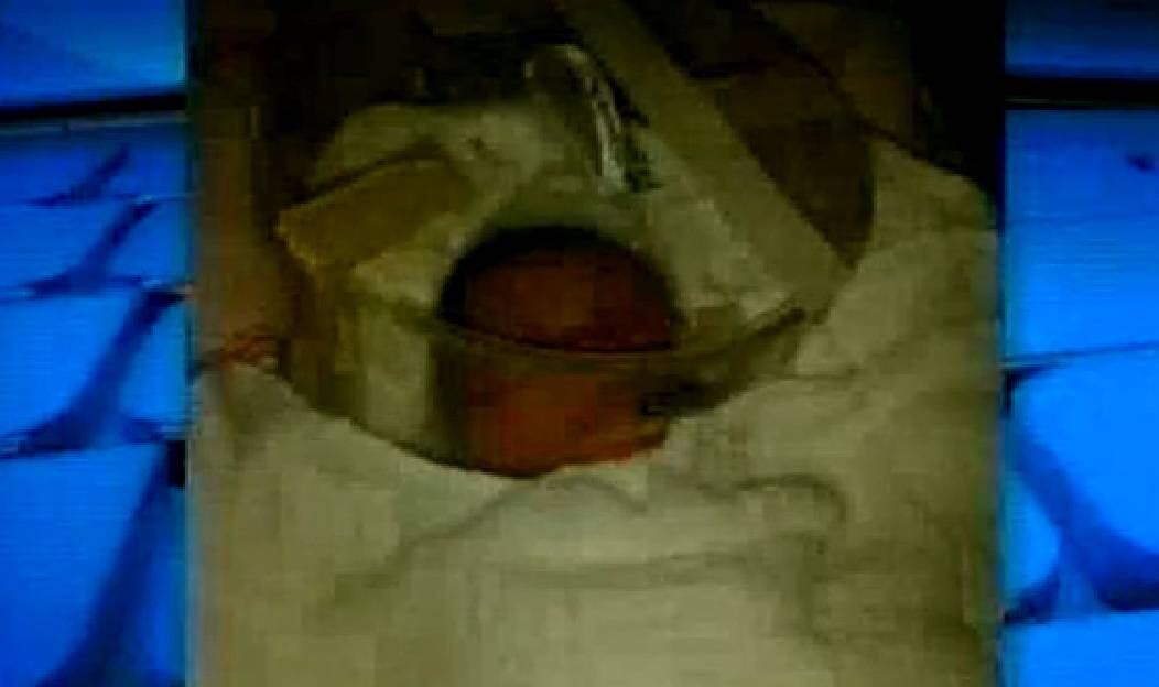 Recém-nascida viveu por somente 20 horas após parto