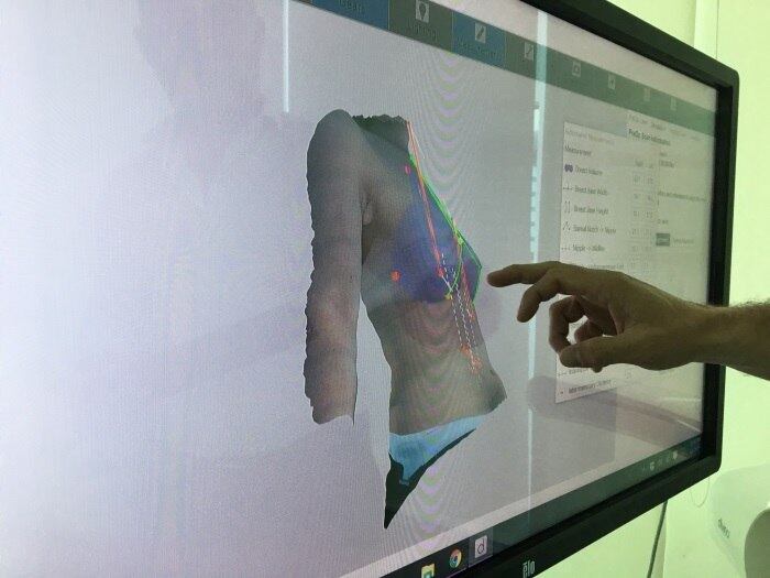 Com exame de imagem tridimensional, mulher e médico conseguem calcular medida da prótese antes da cirurgia