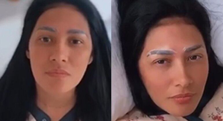 Simaria durante o processo de detox nas sobrancelhas