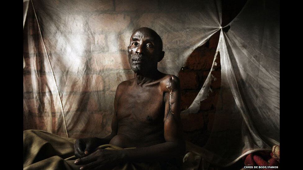 Mathieu Nsanzugwimo retornou ao Burundi, o país mais
pobre da África, em 2008.

Quando voltou, soube que um de seus parentes havia
tomado sua propriedade. Quando tentou reavê-la, amigos e familiares tentaram
matá-lo. Seu parente passou um ano na prisão. No mesmo período, Mattieu
permaneceu internado em um hospital