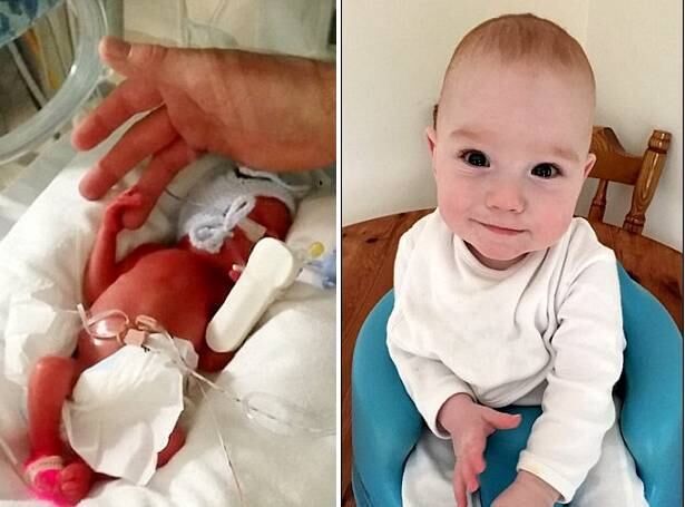 Depois de passar alguns dias sem entrar em trabalho de parto,
Mhairi foi levada para casa. Quase duas semanas após a bolsa estourar, a jovem
começou a ter sangramentos e foi levada às pressas para o hospital