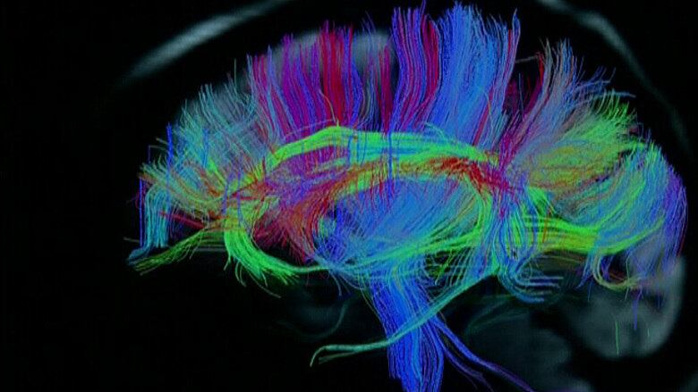 No centro do dispositivo está um algorítmo que traduz os sinais
elétricos do cérebro e duplica eles. Mesmo com essa capacidade de imitar
o funcionamento do cérebro, ele não consegue ler os sinais 