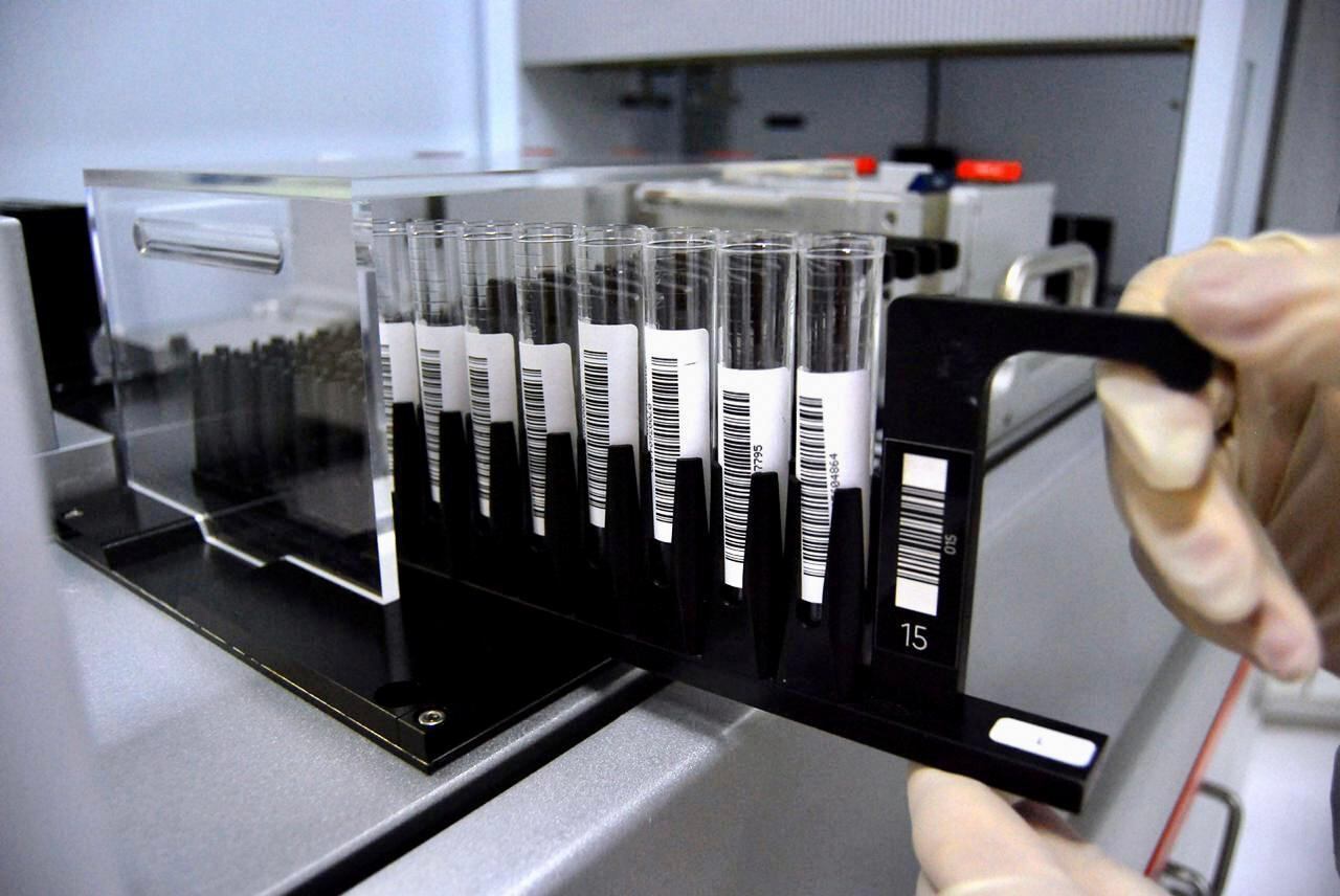 Covid-19: Hemorio aponta aumento de anticorpos na população