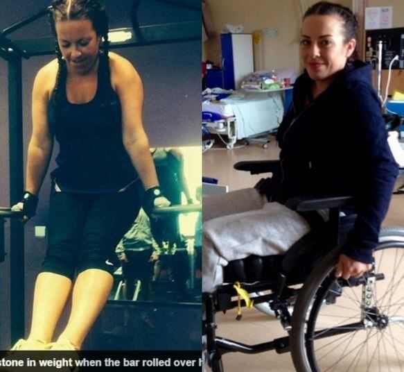 Uma mulher de 31 anos ficou paraplégica após fazer exercício de agachamento com peso na academia. Victoria Griffiths carregava 130 kg (o dobro do seu peso ccorporal) quando escorregou e caiu para a frente. Suas costas estalaram e "dobraram ao meio". As informações são do jornal Daily Mail
