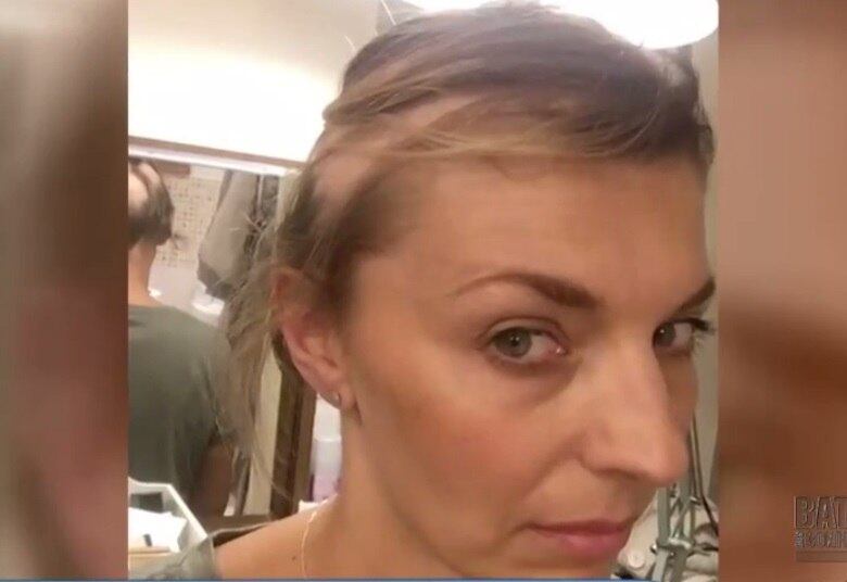 Mas sabia que esse estresse pode provocar queda de cabelo?
Foi o que aconteceu com Michelle Wilson, de 42 anos, que perdeu cerca de 90% dos fios devido ao estresse e problemas