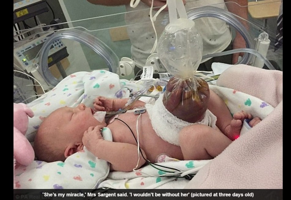 A bebê, cuja causa da doença é desconhecida, só pode comer em seu 19º dia de vida. Agora, depois de 63 dias no hospital e pesando 3,6 kg, Elliotte finalmente poderá ir para casa