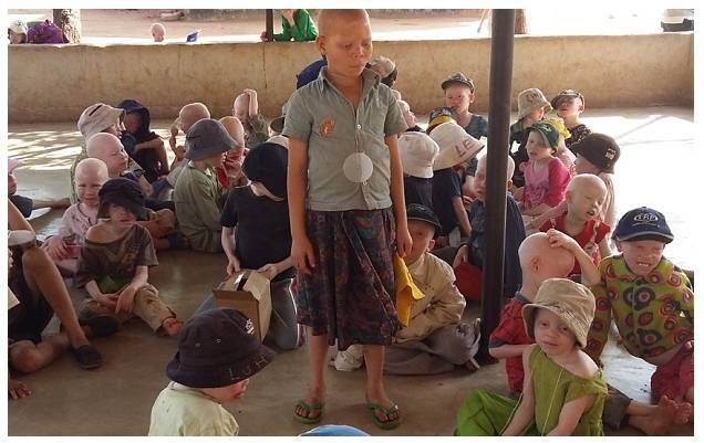 O governo já prendeu 200
médicos-bruxos e, este mês, o ministro de Assuntos Internos garantiu que os
assassinatos de albinos jamais serão aceitos. Ordens de que as províncias os
protejam em suas comunidades foram dadas, mas, com os recursos escassos, a
resposta tem sido ainda mantê-los nos campos de refúgio