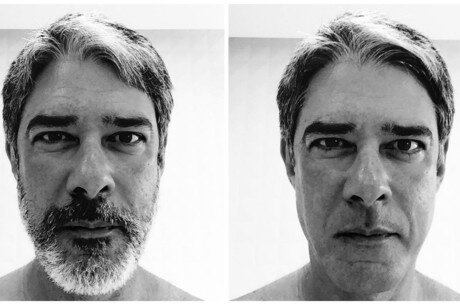 William Bonner mostra antes e depois de barba e diverte fãs