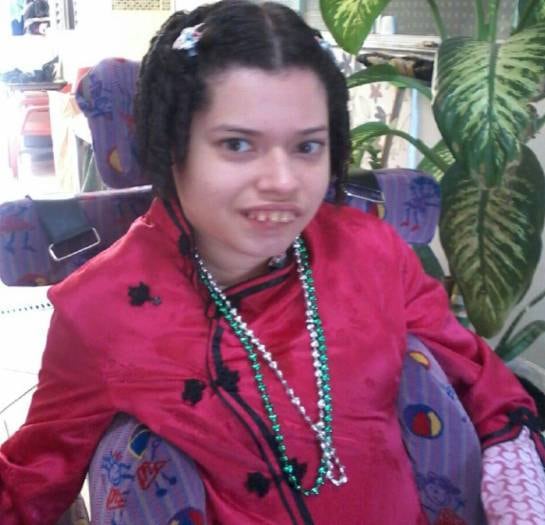 Caroline está com 20 anos e sofre com convulsões permanentes