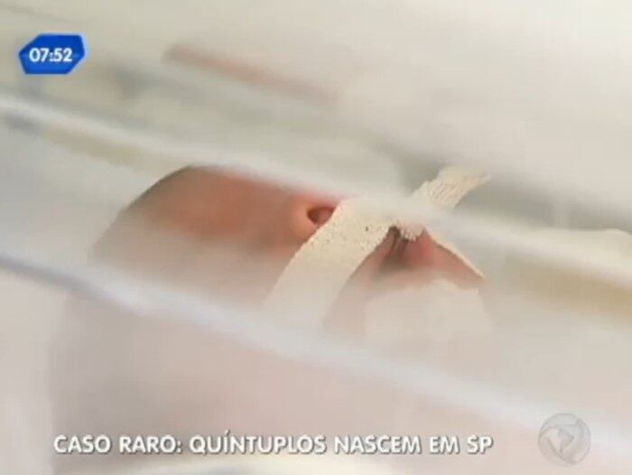 São quatro meninas, e um menino. Juntos pesam
um pouco mais de 4 Kg

Desempregado, pai de quíntuplos ainda não sabe como vai fazer para sustentar os filhos





