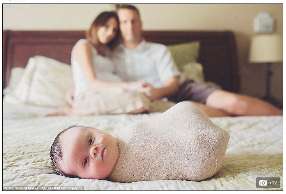 Foi em um
exame de rotina que Erika e Stephen Jones ficaram sabendo que a bebê que
esperavam nasceria com síndrome de Down. A família, que já tinha também outra
menina, Audrey, de dois anos, ainda estava lidando com a notícia quando outro
diagnóstico apareceu.


Na 30ª
semana de gestação, o casal descobriu que a filha tinha também um câncer
inoperável no cérebro, e que não havia nada que eles pudessem fazer quanto a
isso

