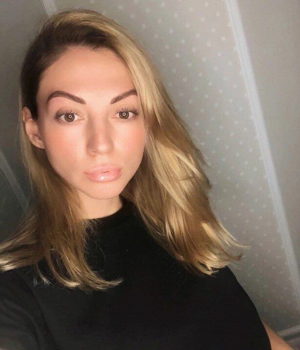 Influencer russa passou mal durante procedimento estético e médicos não conseguiram impedir sua morte