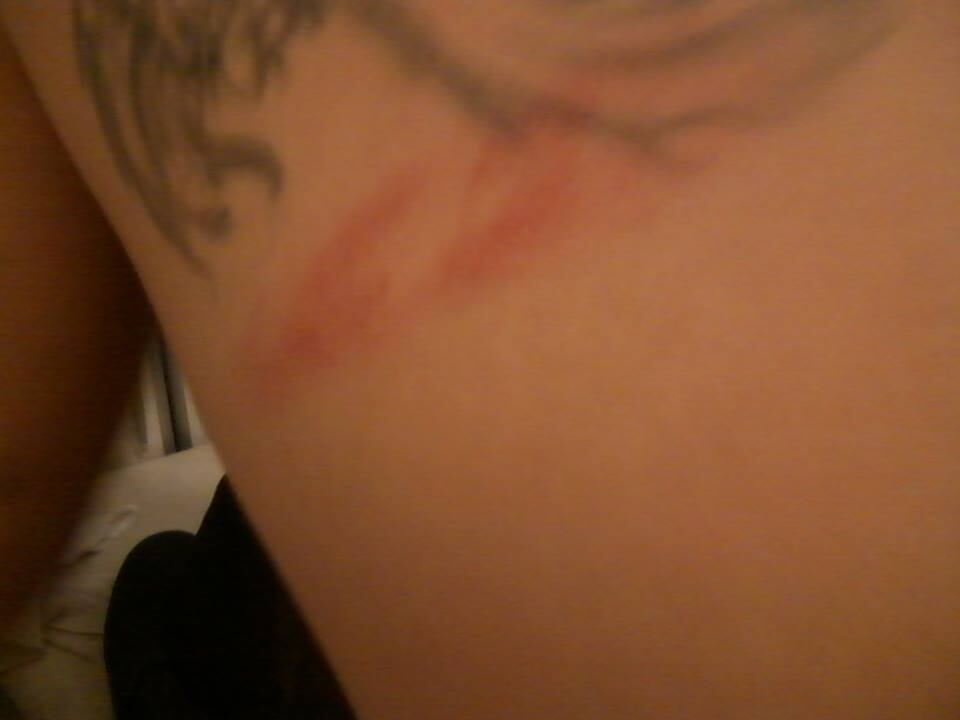 De
acordo com o ativista, ele não conseguiu registrar um boletim de ocorrência
contra os agressores naquele momento e tentou de fazê-lo no dia seguinte, mas
foi zombado e os agentes não registraram o caso. 


—
Eles alegaram  que não era da alçada deles, que eles não tinham obrigação
de fazer isso, que isso era com a corregedoria. [...] Disseram: “a Polícia
Civil não tem nada a ver com seu caso”. [...] Praticamente zombando da minha
cara, duvidando da minha palavra, me botando como um vândalo. Falaram: “então,
você é santinho estava lá rezando, estava lá brincando”