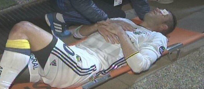 Van Persie foi retirado de campo e levado ao hospital para suturar e tratar do ferimento