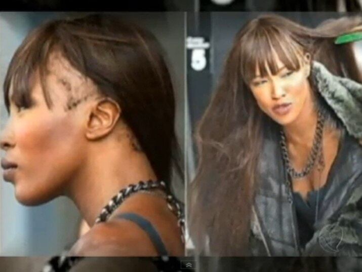 Nas passarelas o cabelo
sempre foi à marca registrada de Naomi Campbel. Mas para manter os fios longos, a modelo britânica sofre com as consequências

No R7 Play você pode assistir ao Fala Brasil na íntegra! Clique e experimente de graça! 
+ Famosas perdem cabelos em decorrência de apliques; entenda os riscos
+ Tratamento inovador promete dar fim às tão indesejáveis estrias. Veja!
+ Famosas bebem vinagre de maçã para afinar a silhueta e manter a beleza

