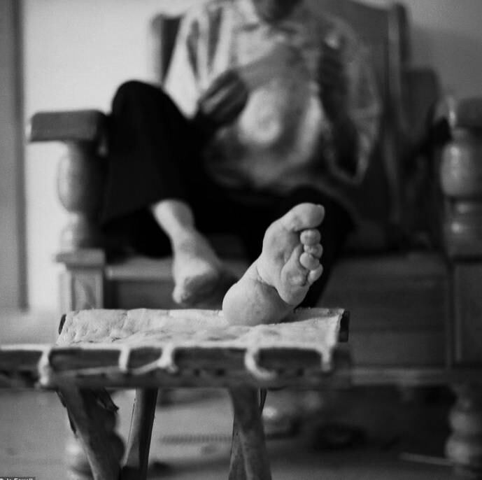 As modificações aconteciam quando as mulheres tinham de quatro a nove anos e seus pés estavam totalmente desenvolvidos. 

Segundo o tabloide britânico Daily Mail, o processo era realizado, em sua maioria, durante os meses de inverno, quando os pés estavam dormentes por causa do frio 