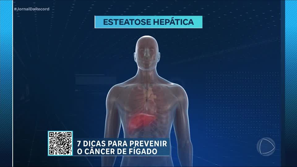 Consumo de alimentos saudáveis pode evitar o acúmulo de gordura no fígado