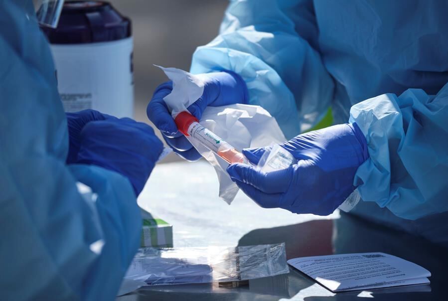 Governo quer distribuir até 5 milhões de kits de testes rápidos para coronavírus
