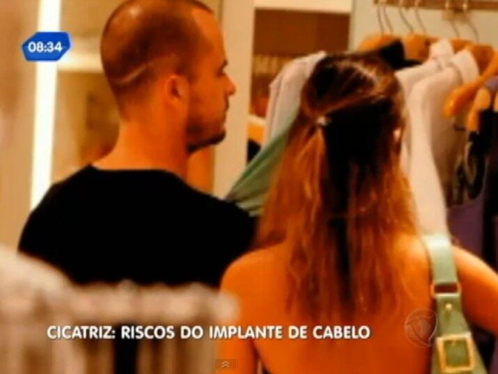 A cicatriz é bem visível, vai de um lado ao outro da cabeça. Paulinho Vilhena declarou que a marca é consequência de um transplante capilar que deu errado
+ Implante capilar: conheça os riscos do procedimento