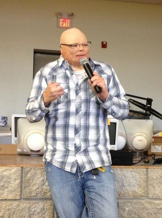 Há dez anos, Brad Hearon, 30 anos, do Colorado, Estados Unidos, era viciado em drogas. Mas um trágico acidente que queimou 80% de seu corpo transformou a sua vida. Porém, depois de passar praticamente um ano inteiro no hospital e, de lá para cá, passar por várias cirurgias, Brad deu a volta por cima. Saiba mais