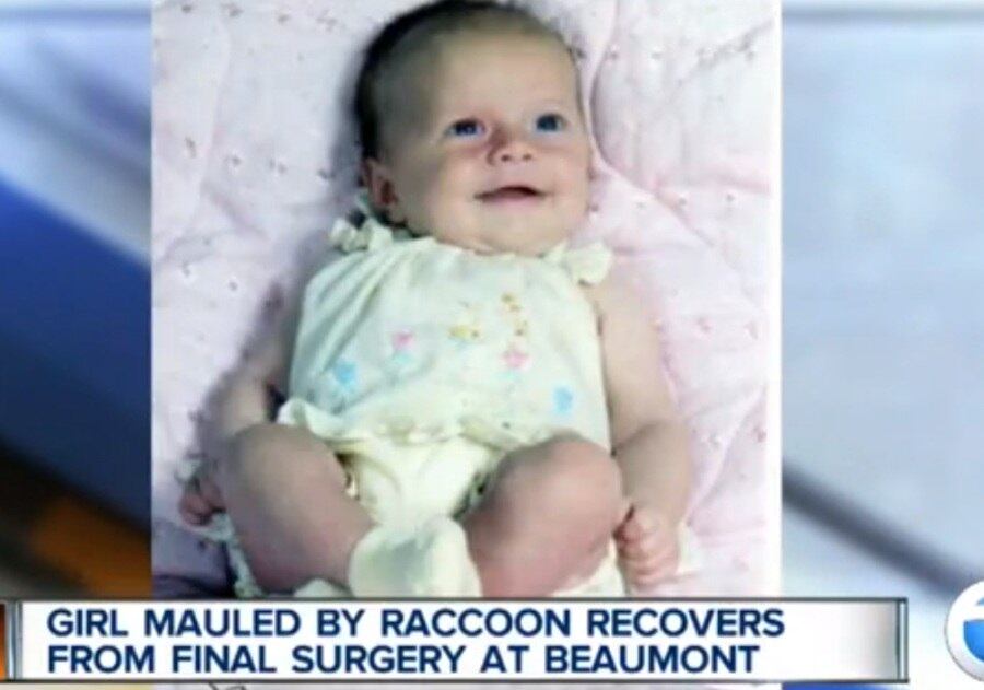 

Charlotte foi atacada pelo animal quando ainda era bebê

