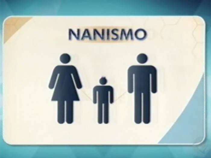 

O nanismo é uma doença hereditária e genética, ou seja, pode
passar de pai para filho. Ela acontece por uma mutação do receptor responsável pela
formação do crescimento dos ossos. Com a perda destas informações, os ossos
perdem a capacidade de crescer normalmente, principalmente, em comprimento

+ Aproveite e confira as matérias do programa Domingo Show

+ Já curtiu a página do Domingo Show no Facebook? É só clicar!

+ Siga o Domingo Show no Twitter e receba todas as notícias do programa
