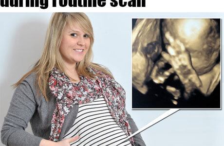 Os britânicos Anne-Marie Ronald, de 25 anos, e seu marido Ben, de 29 anos, não contiveram a risada ao ver a imagem de seu filho fazendo um gesto obsceno durante um exame de ultrassom. Anne está grávida de 28 semanas