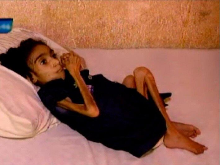 Apesar de já ter 22 anos, a baiana Itamara é sofre da síndrome da regressão e tem a aparência de uma criança de três anos. Conheça sua história!