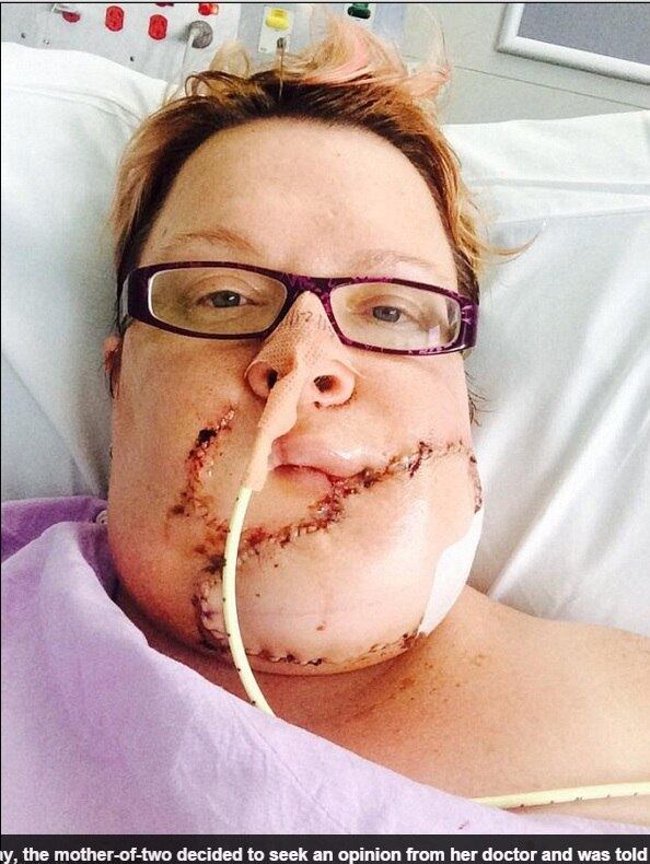 Segundo informações do site Daily Mail, Jodie
conta que, quando percebeu o primeiro nódulo em seu queixo, pensou que era uma
espinha causada pelo estresse da maternidade (na época, ela estava grávida)