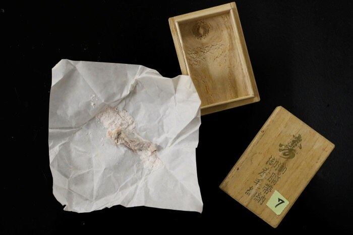 Hirokatsu Akagi, diretor do Laboratório Internacional de Mercúrio da Minamata, relata que pessoas ainda enviam cordões umbilicais com décadas de idade para serem analisados. Elas esperam que as evidências as ajudem a conseguir compensação legal por seu sofrimento