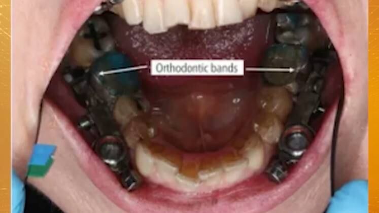 O aparelho ainda está em fase de testes.

Continue acompanhando o Fala Brasil. De segunda a sexta, a partir das 8h30; e aos sábados, às 7h35, na Record TV
