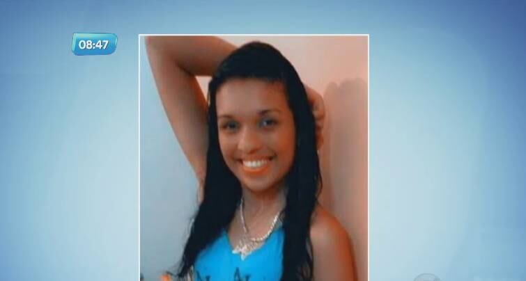 Aline teve queimaduras de 2º grau pelo corpo e está internada em estado grave. A família informou que ela corre o risco de perder a visão de um olho 