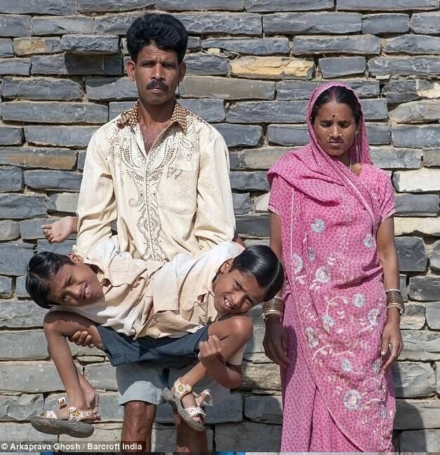 Com o tempo, eles aprenderam a fazer todas as tarefas diárias básicas facilmente, como tomar banho, comer, se vestir, e até pentear o cabelo um do outro. Veja o que aconteceu com os gêmeos