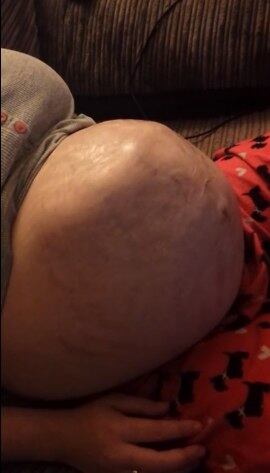 É possível ver perfeitamente as pernas e braços do bebê