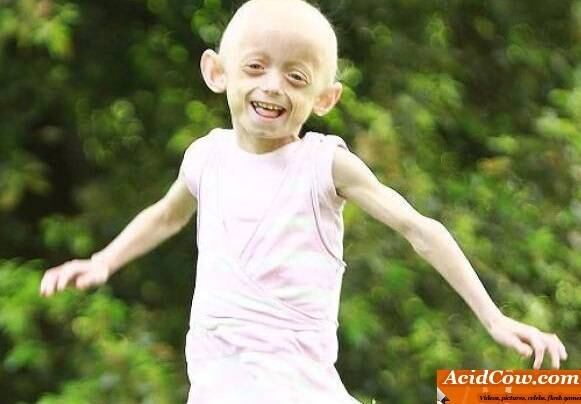 

— A minha mãe diz que eu sou diferente, como todo mundo é
diferente. Se alguém me olha diferente, eu apenas sorrio

