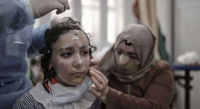 Incêndio causado por vazamento de gás em campo de refugiados atingiu garota